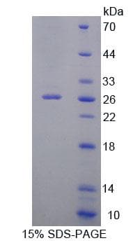 Human DNAJC2 / ZRF1 Protein (Recombinant His-T7)