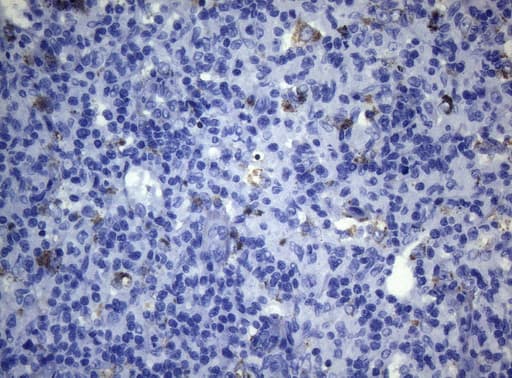 CTSL / Cathepsin L Antibody (clone OTI6B8)