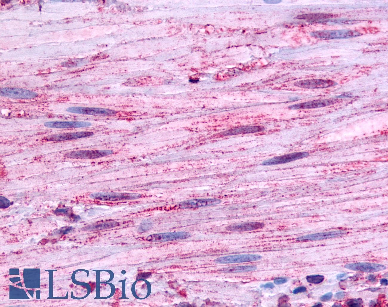 PathPlus™ B1R / BDKRB1 Antibody (Extracellular Domain)