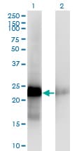 Monoclonal Mouse anti-Human CITED1 Antibody (clone 5H6, IHC, WB)