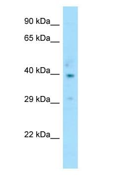 CCR2 Antibody (aa246-295)