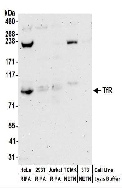 Polyclonal Rabbit anti-Human CD71 / Transferrin Receptor Antibody (aa125-175, WB)