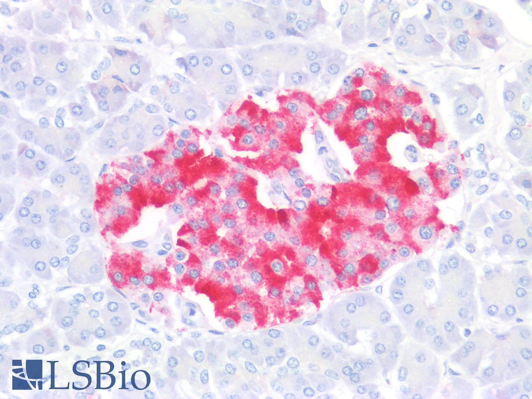 IHC-plus™ Polyclonal Rabbit anti-Human RARRES2 / Chemerin Antibody (N-Terminus, IHC, IF, WB)