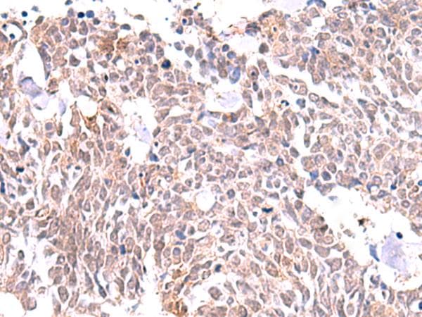 INPP5K / SKIP Antibody