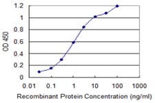 IHC-plus™ Monoclonal Mouse anti-Human c-Kit / CD117 Antibody (clone 6G12, IHC, WB)