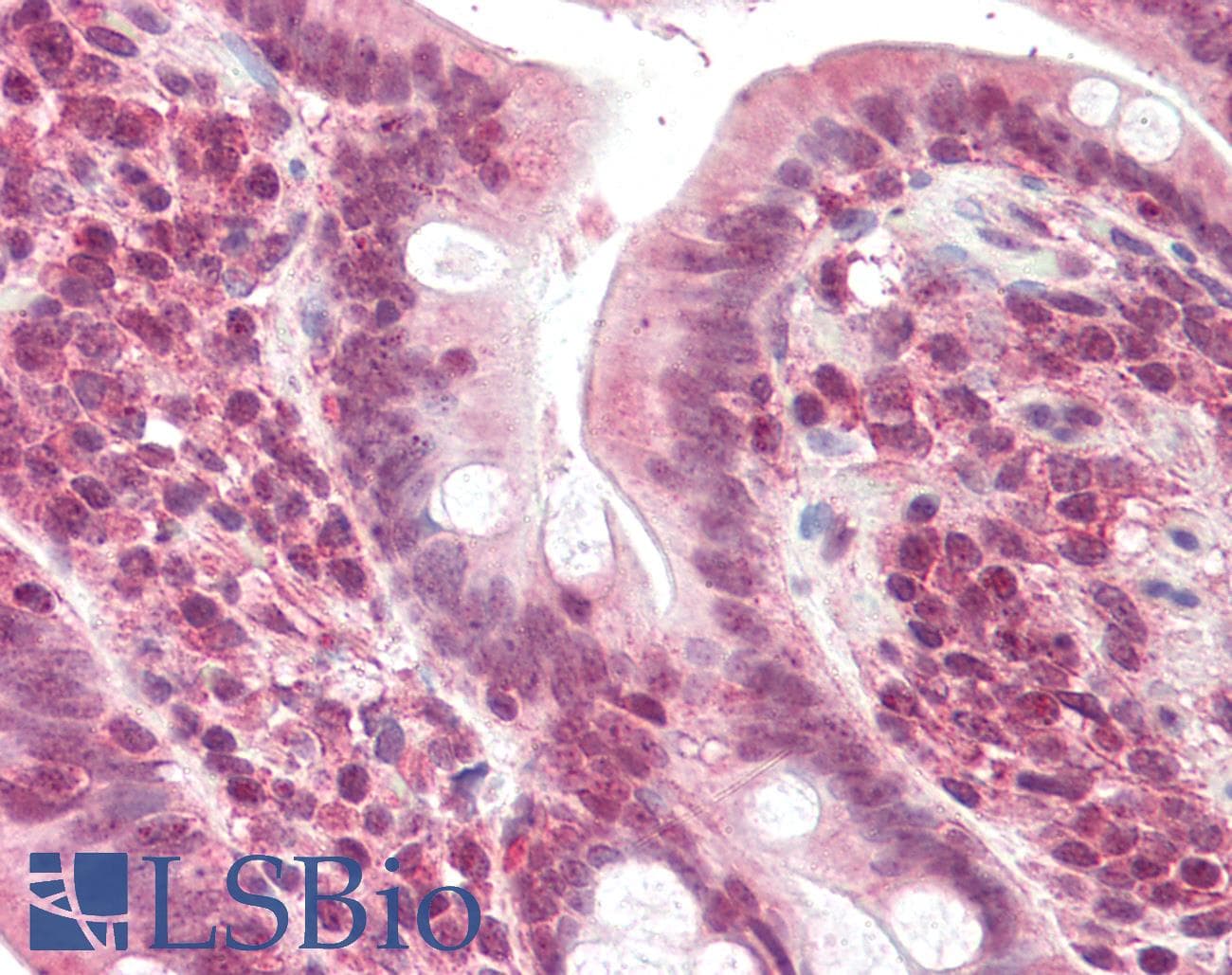 IHC-plus™ Polyclonal Goat anti-Human POLL / DNA Polymerase Lambda Antibody (aa563-575, IHC, WB)