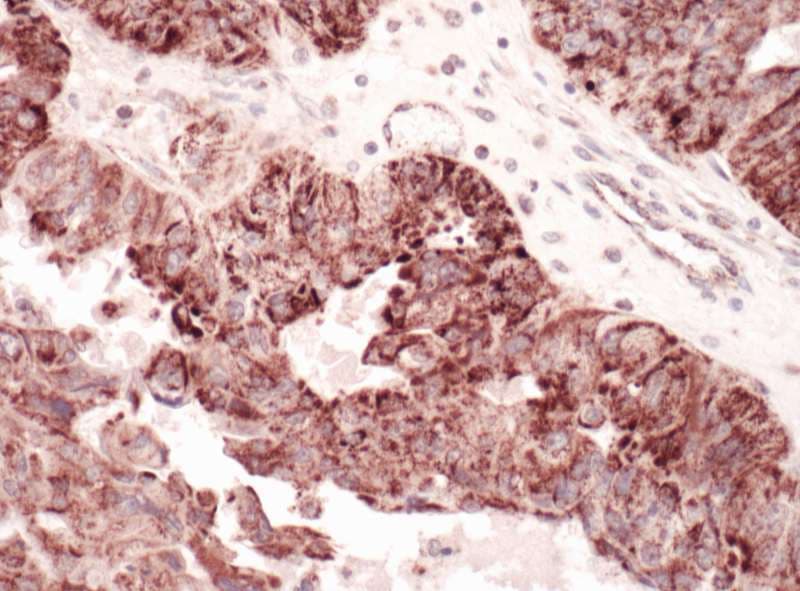 GC1qR / C1QBP Antibody (aa232-282)