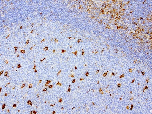 Vimentin Antibody (aa210-466, clone UMAB159)