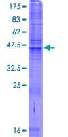 Human SLC35A3 Protein (Recombinant GST)