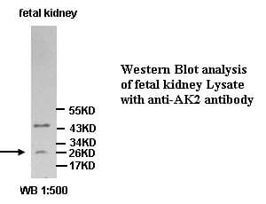 AK2 / Adenylate Kinase 2 Antibody (Internal)