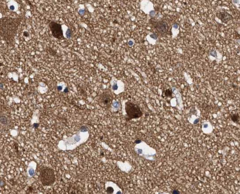 MAPK8 / JNK1 Antibody (phospho-Thr183,pTyr185)