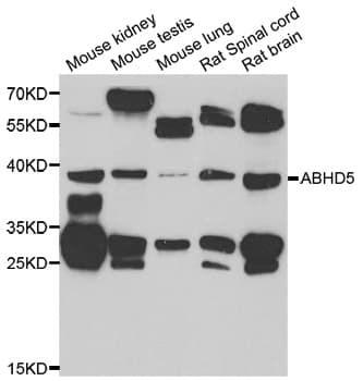 ABHD5 Antibody