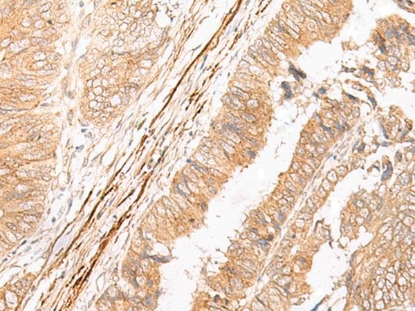 EPS15 Antibody
