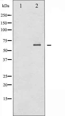 Polyclonal Rabbit anti-Human PTPN11 / SHP-2 / NS1 Antibody (IHC, IF, WB)