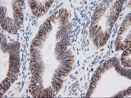 IRF6 Antibody (clone OTI2A12)