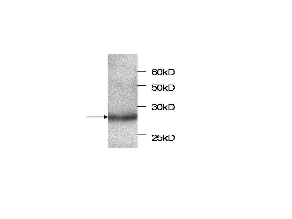 Monoclonal Mouse anti-Human SERPINB4 / SCCA1+2 Antibody (WB)