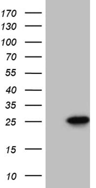 CIB1 / KIP Antibody (aa2-191, clone OTI1B8)