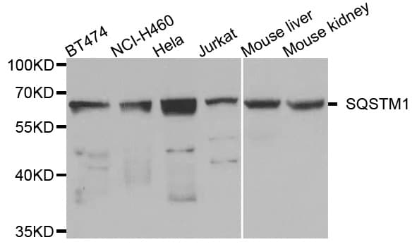 Polyclonal Rabbit anti-Human SQSTM1 Antibody (WB)