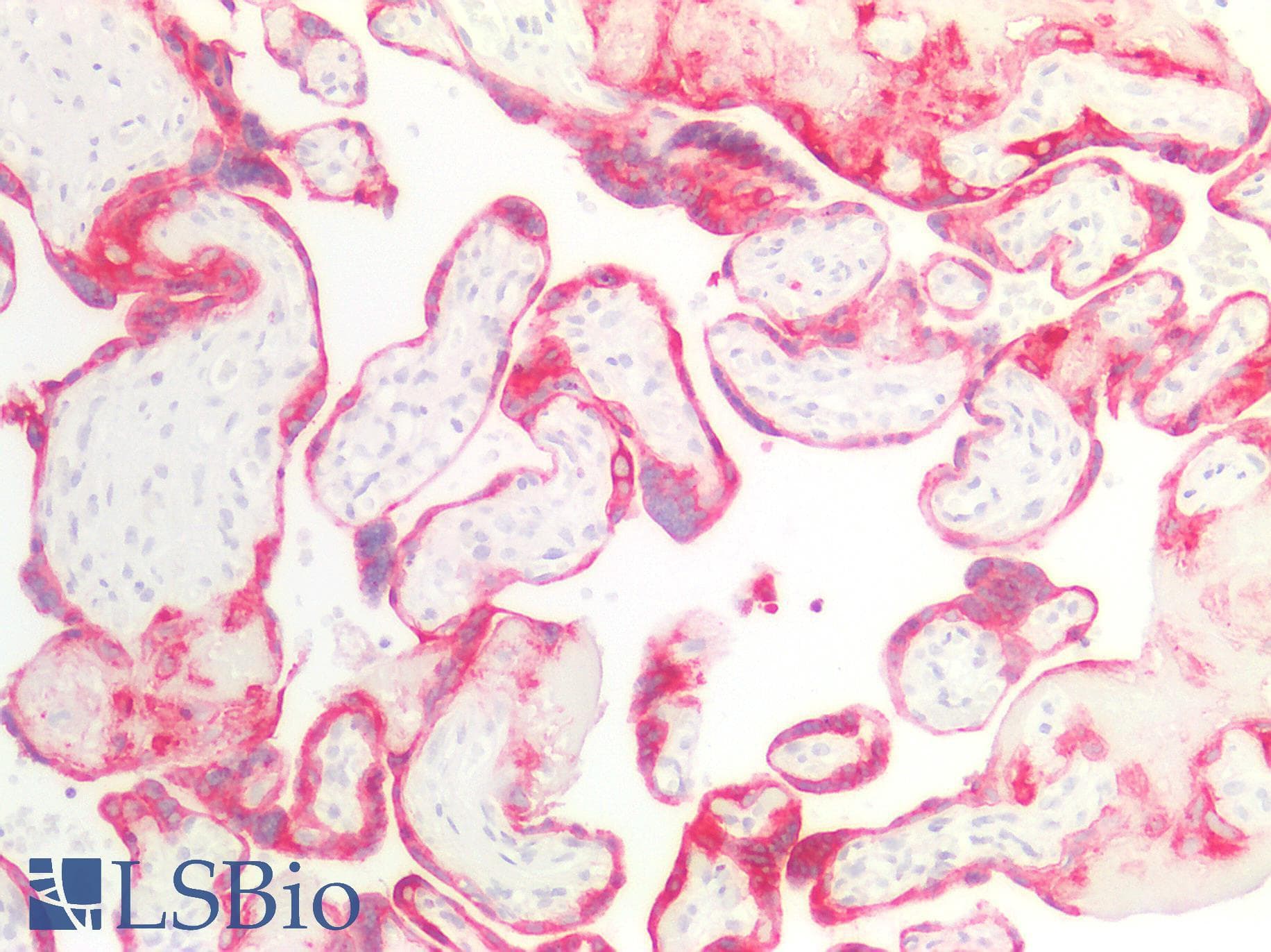 PathPlus™ Acidic Cytokeratin AE1 Antibody (clone AE-1, Concentrated)