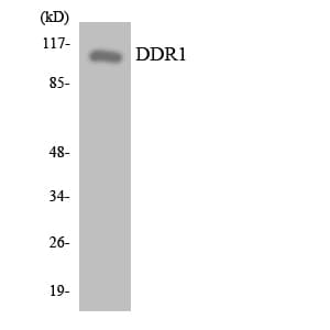 NEP / DDR1 Antibody (aa276-325)