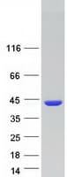 Human DDX / AKR1C3 Protein (Recombinant Myc-DDK (Flag))