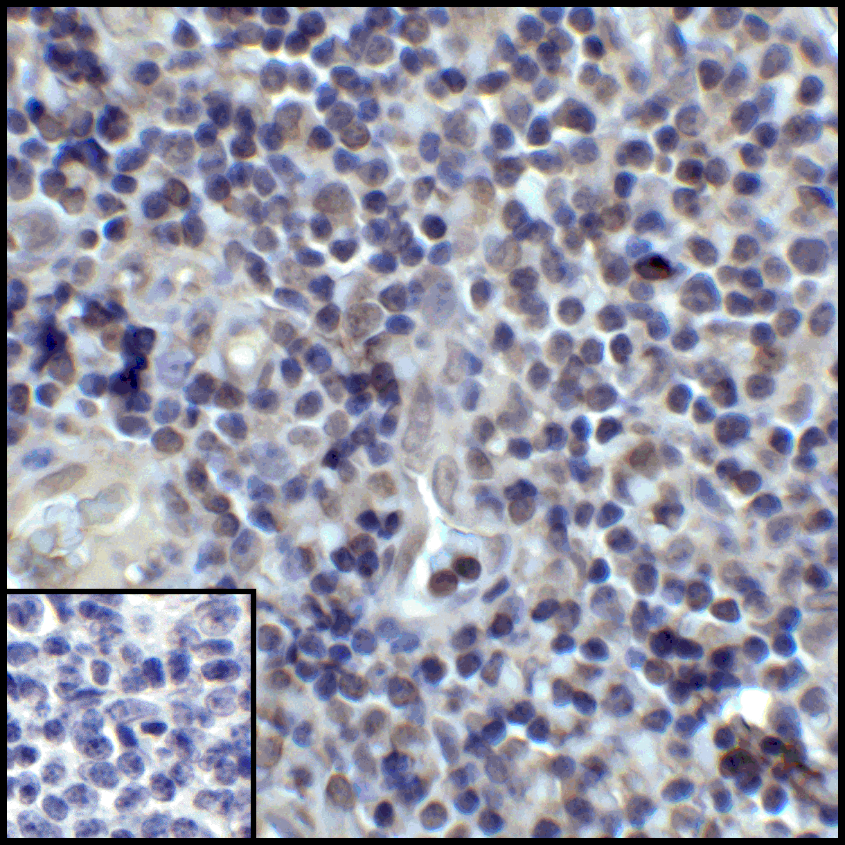 Monoclonal Mouse anti-Human CD274 / B7-H1 / PD-L1 Antibody (clone 2D6, IHC, IF, WB)