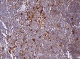 IDH1 / IDH Antibody (clone OTI24A2)