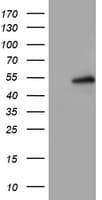 LPL / Lipoprotein Lipase Antibody (aa28-475, clone OTI3F9)