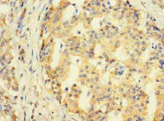 Polyclonal Rabbit anti-Human SYTL3 Antibody