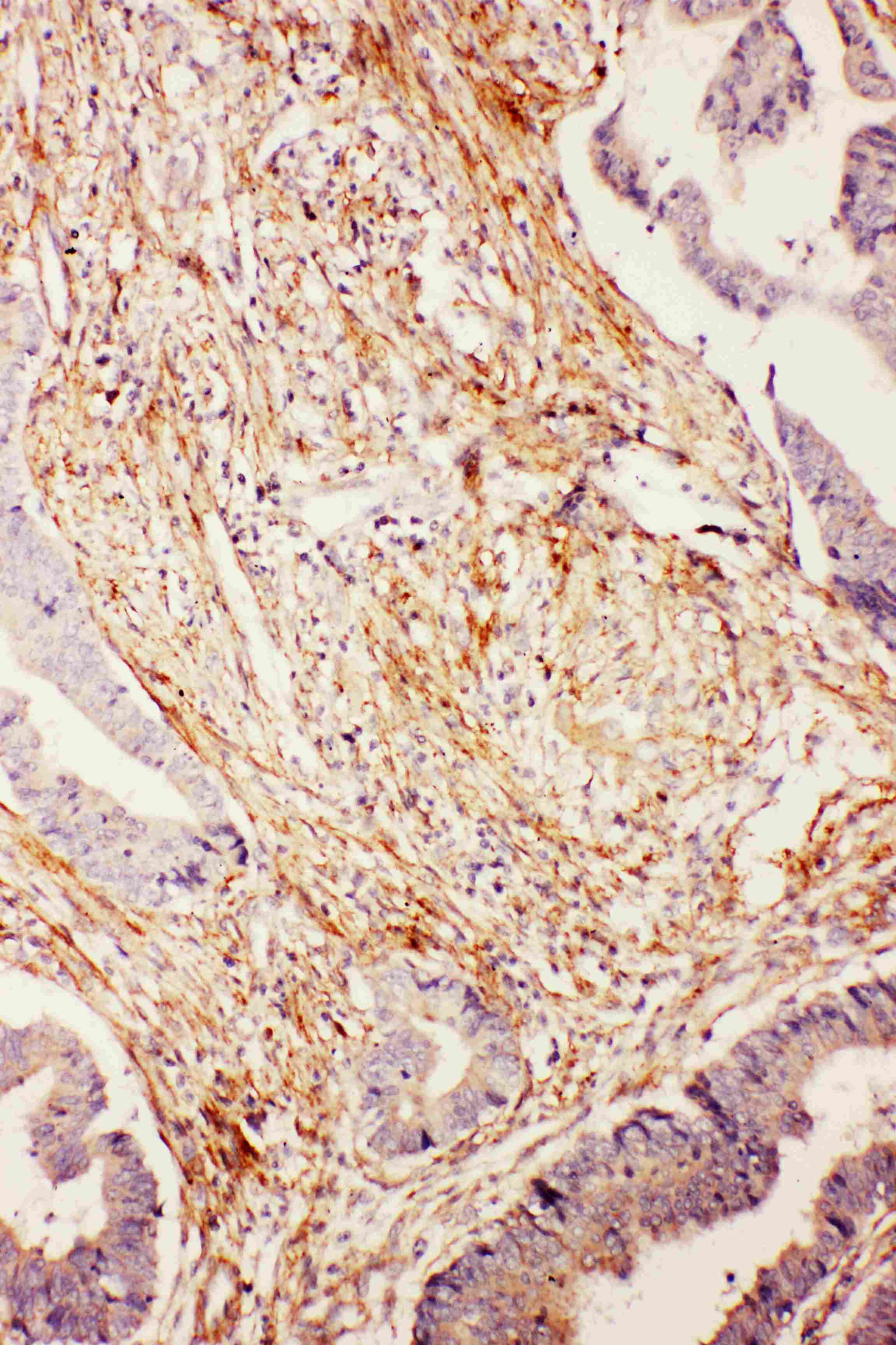 Polyclonal Rabbit anti-Human FAT10 / UBD Antibody (aa27-40, IHC, WB)