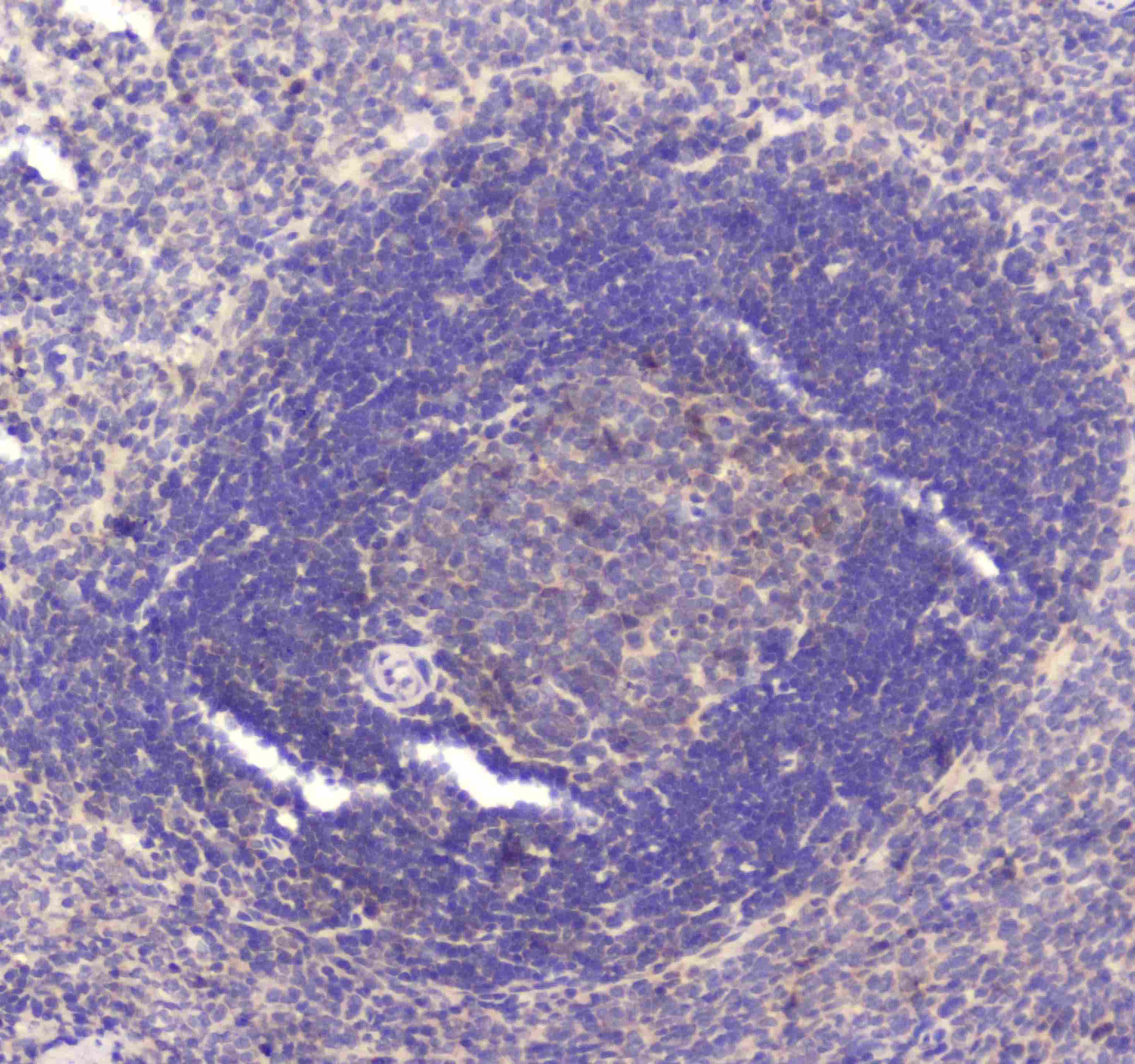 Polyclonal Rabbit anti-Human RAB27A / RAB27 Antibody (IHC, WB)