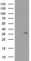 Monoclonal Mouse anti-Human SDR9C7 Antibody (clone OTI4H9, WB)