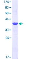 Human S100A9 / MRP14 Protein (Recombinant GST)