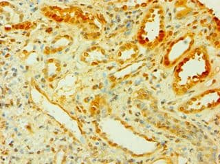IHC-plus™ CISH / SOCS Antibody (aa1-257)