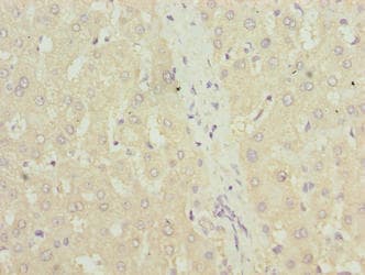 TRXR1 / TXNRD1 Antibody (aa1-497)