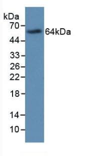PRG2 / Proteoglycan 2 Antibody (aa105-222)