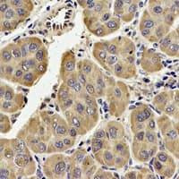TECR / TER Antibody (C-Terminus)