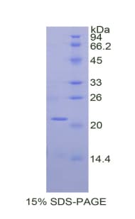 Mouse SPTAN1 / Alpha Fodrin Protein (Recombinant His)