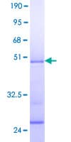 Human CIRP / CIRBP Protein (Recombinant GST)