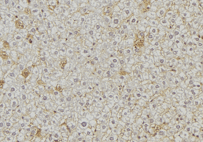 Polyclonal Rabbit anti-Human ARSA / Arylsulfatase A Antibody (IHC, IF, WB)