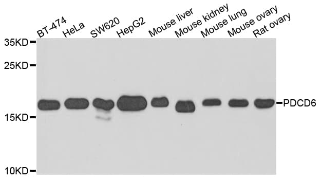 IHC-plus™ PDCD6 / ALG-2 Antibody