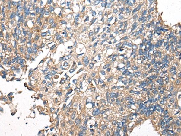 Polyclonal Rabbit anti-Human CDC42BPA / MRCK Antibody (IHC)