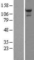 STK31 Protein (Over-Expression Lysate Myc-DDK (Flag))