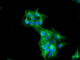 TUBAL3 Antibody (clone OTI5E4)