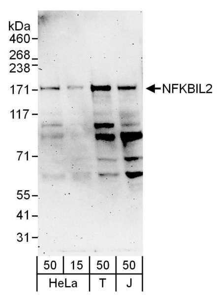 Polyclonal Rabbit anti-Human TONSL Antibody (aa425-475, WB)