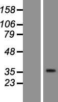 OR10H1 Protein (Over-Expression Lysate Myc-DDK (Flag))