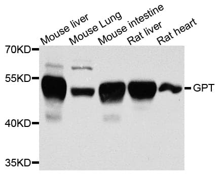Polyclonal Rabbit anti-Human GPT / Alanine Transaminase Antibody (IHC, WB)