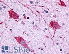 PathPlus™ Polyclonal Rabbit anti-Human GPR146 Antibody (Cytoplasmic Domain, IHC)