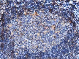 Monoclonal Mouse anti-Human ARHGAP25 Antibody (clone OTI11B9, IHC, IF, WB)
