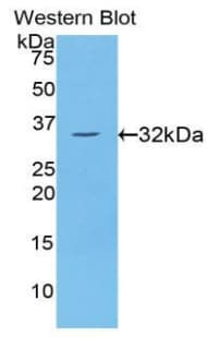 PRKCH / PKC-Eta Antibody (aa355-614)